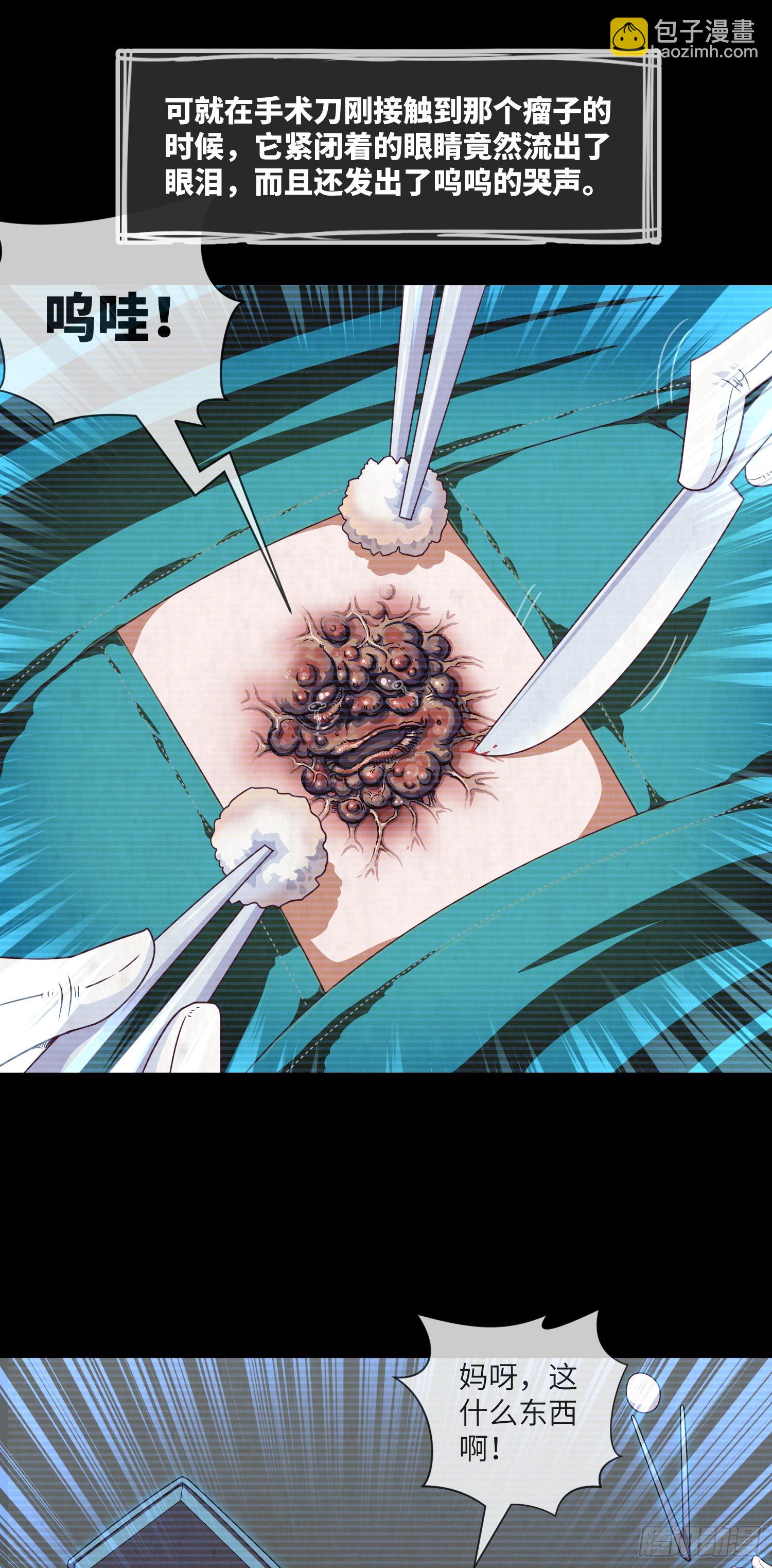 第44话 人面瘤-第46话