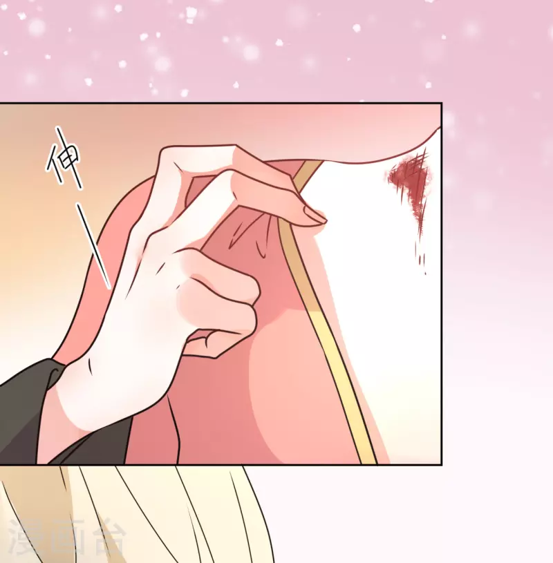 第51话 亲手为她上药-第52话