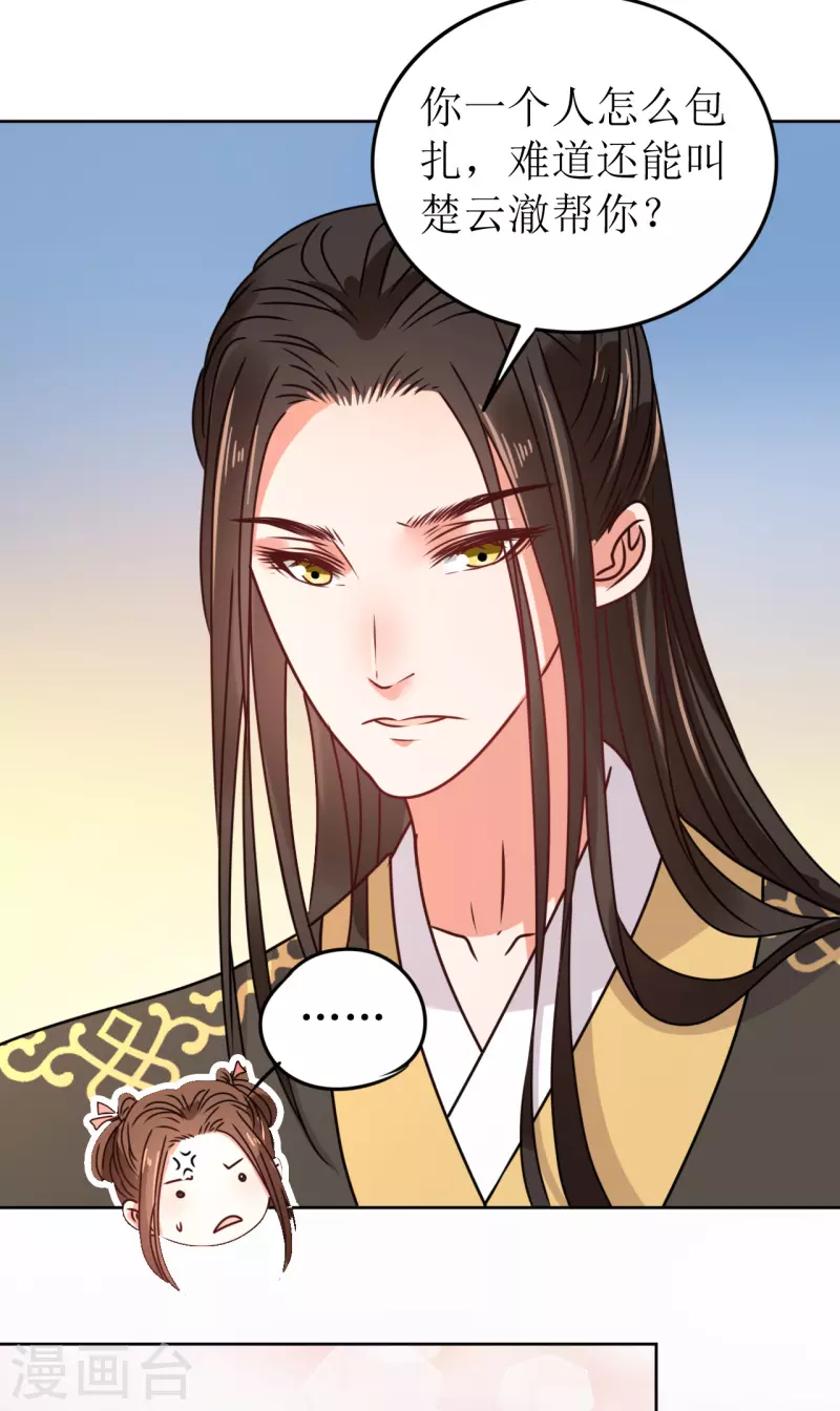 第51话 亲手为她上药-第52话