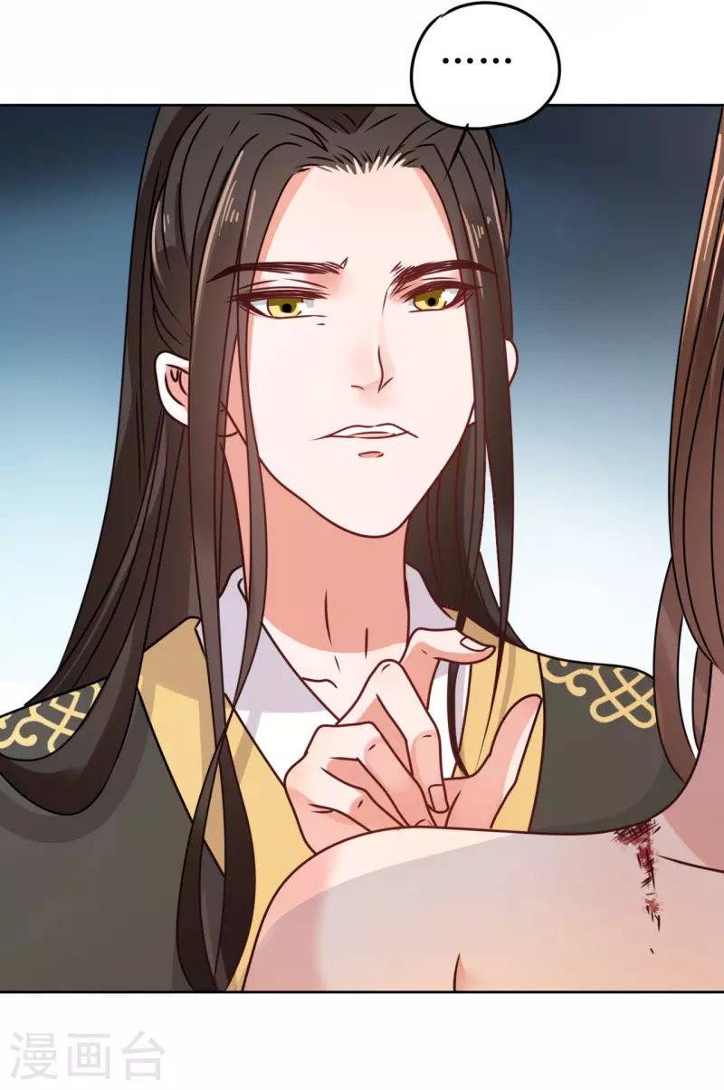 第51话 亲手为她上药-第52话