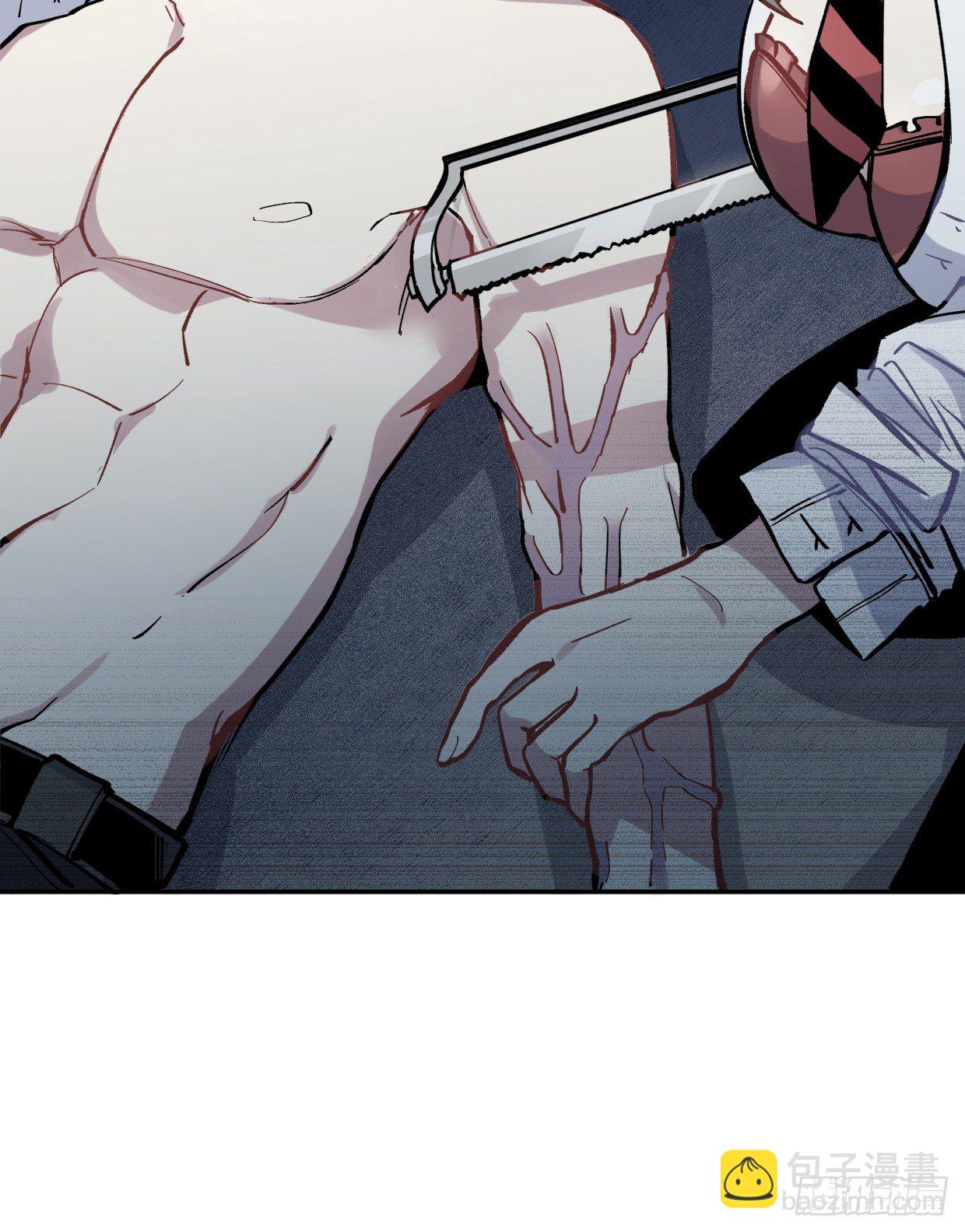 截肢（一）-第12话