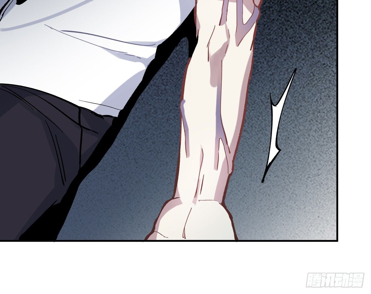 截肢（一）-第12话