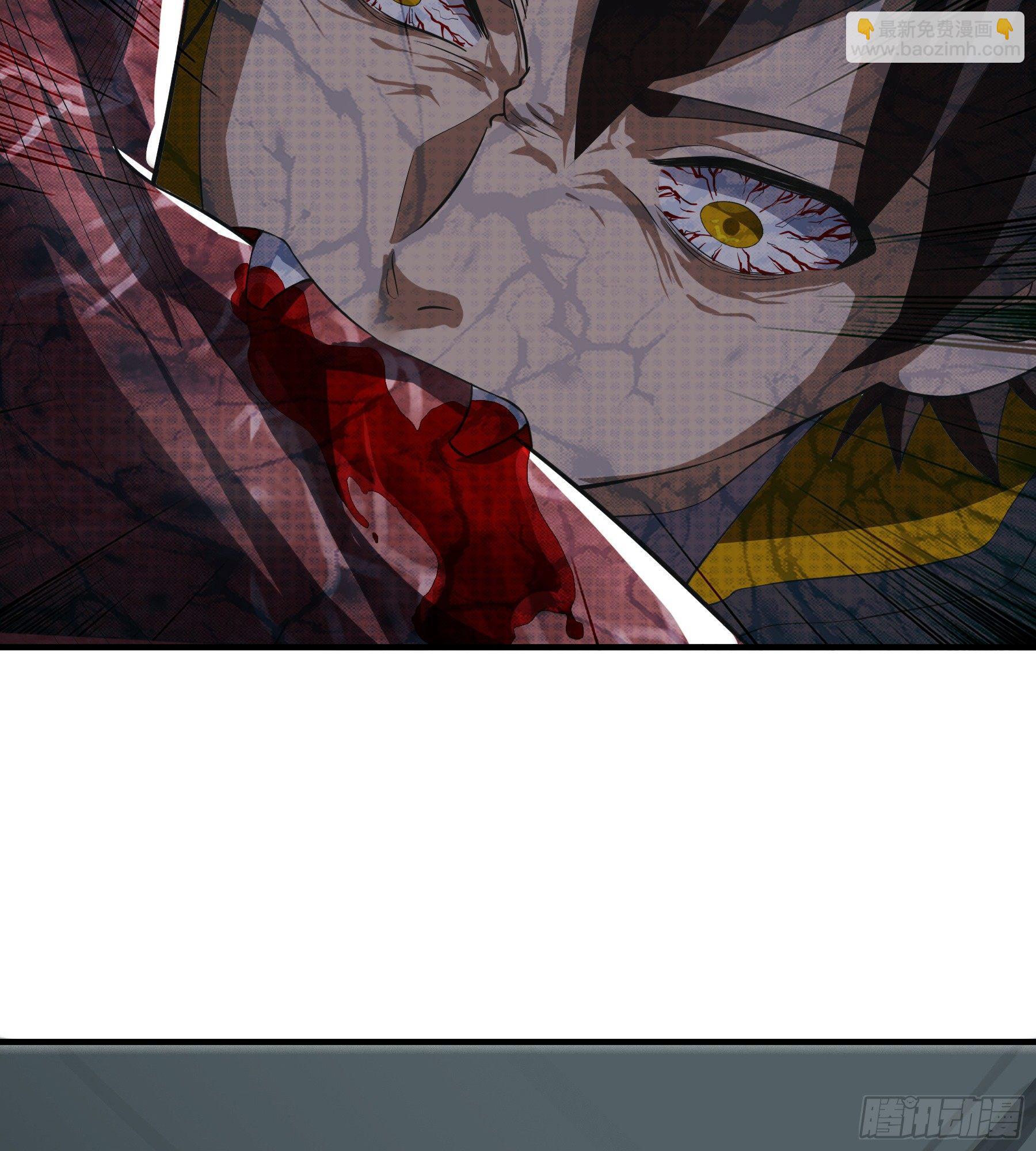 第3话：感染(1/2)-第4话