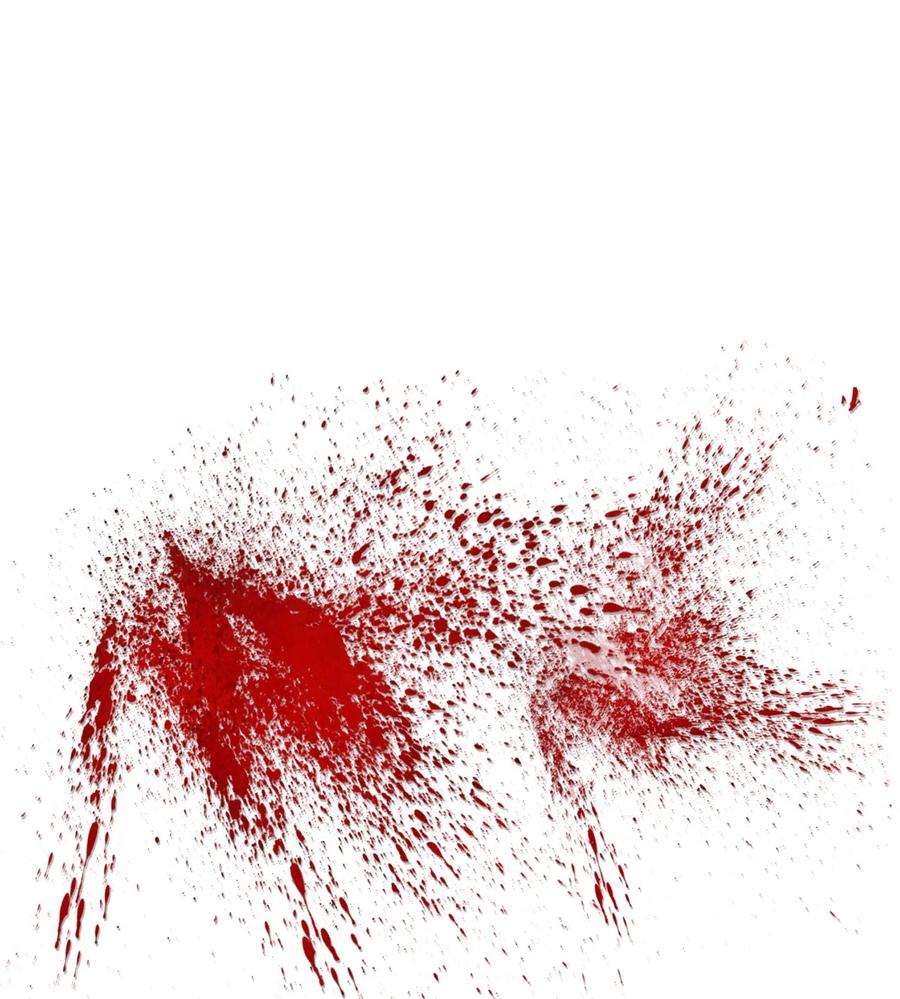 59 偷袭（2）(1/2)-第60话