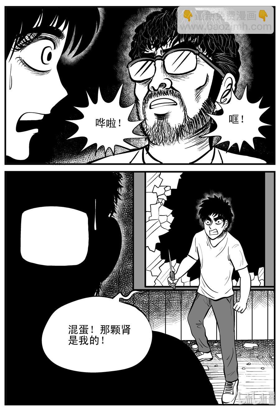 小智怪談 - 206 誰偷了我的腎（2） - 1