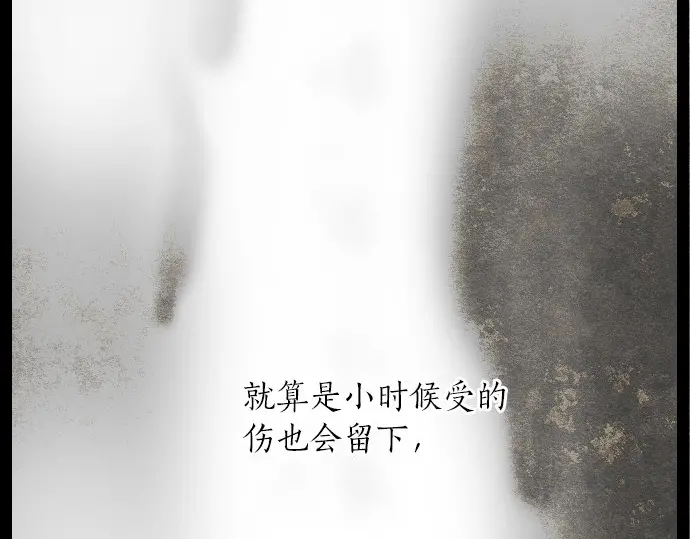 第20话 若想治愈伤口2(1/4)-第20话