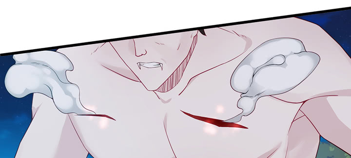 134话 重伤(1/3)-第134话