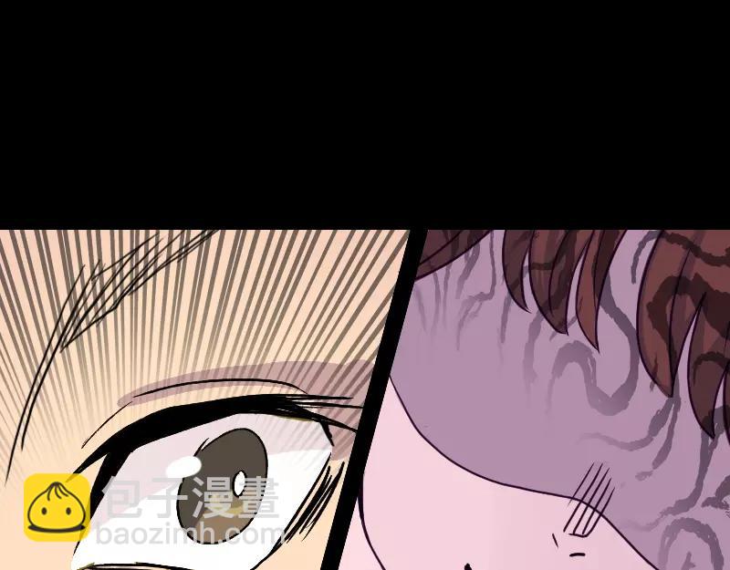 第9话 别人的腿(1/2)-第10话