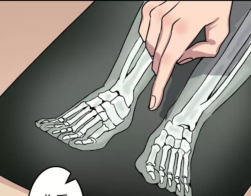 第9话 别人的腿(1/2)-第10话