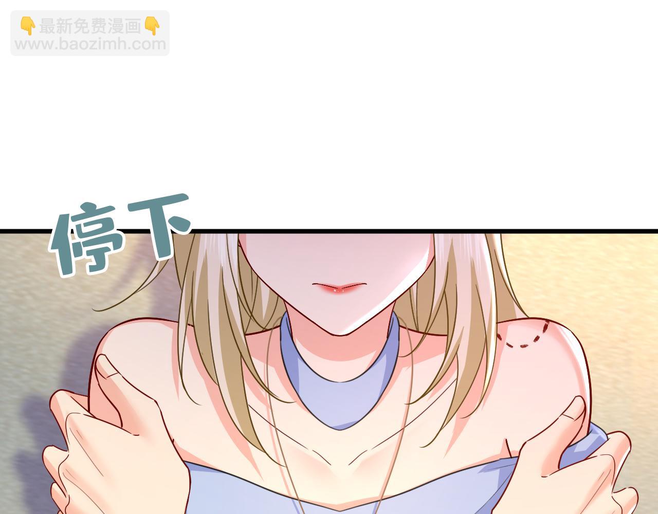 總裁在上 - 第542話 你的手怎麼回事？(2/3) - 8